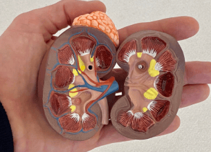 kidney_transplantation