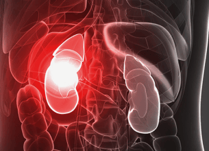 Renal Nutrition and Dietetics: Supporting Kidney-Friendly 
                Nutrition