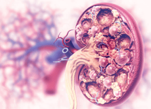 Pediatric Nephrology: Caring for Our Youngest Patients