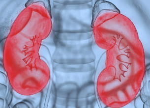 Research and Innovation: Advancing Nephrology Care